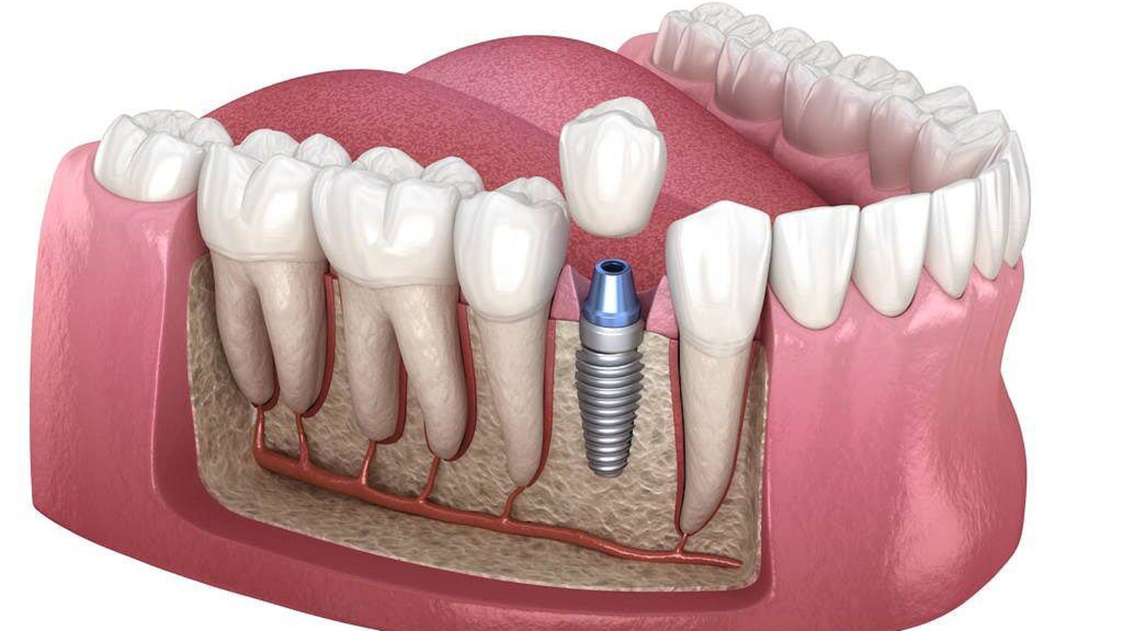 photo_2026-03-18_11-04-04