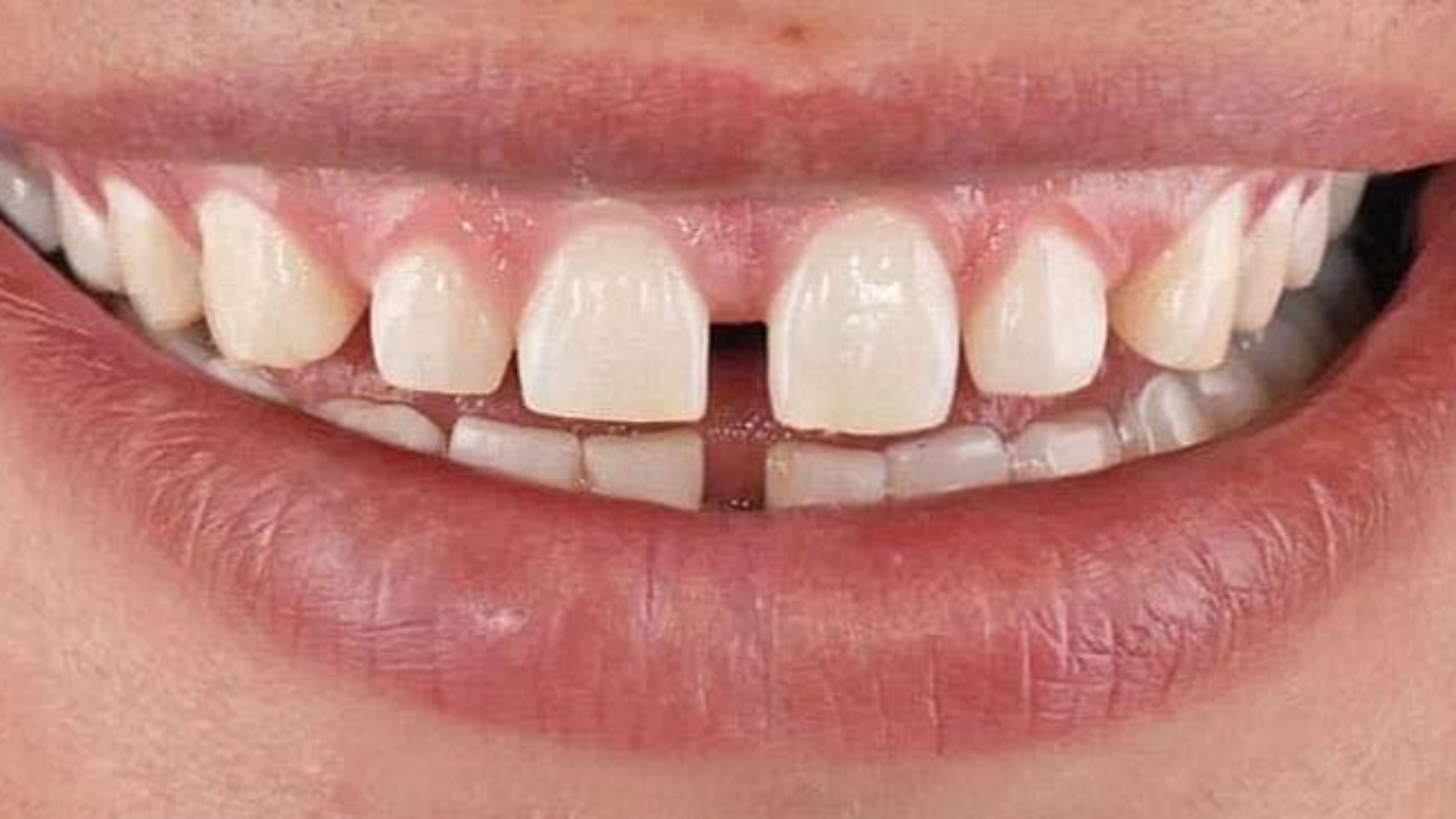 photo_2026-03-26_11-39-43