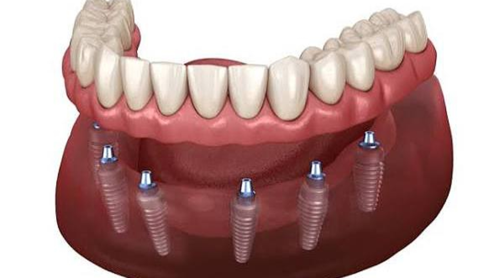 photo_2026-03-26_11-41-23