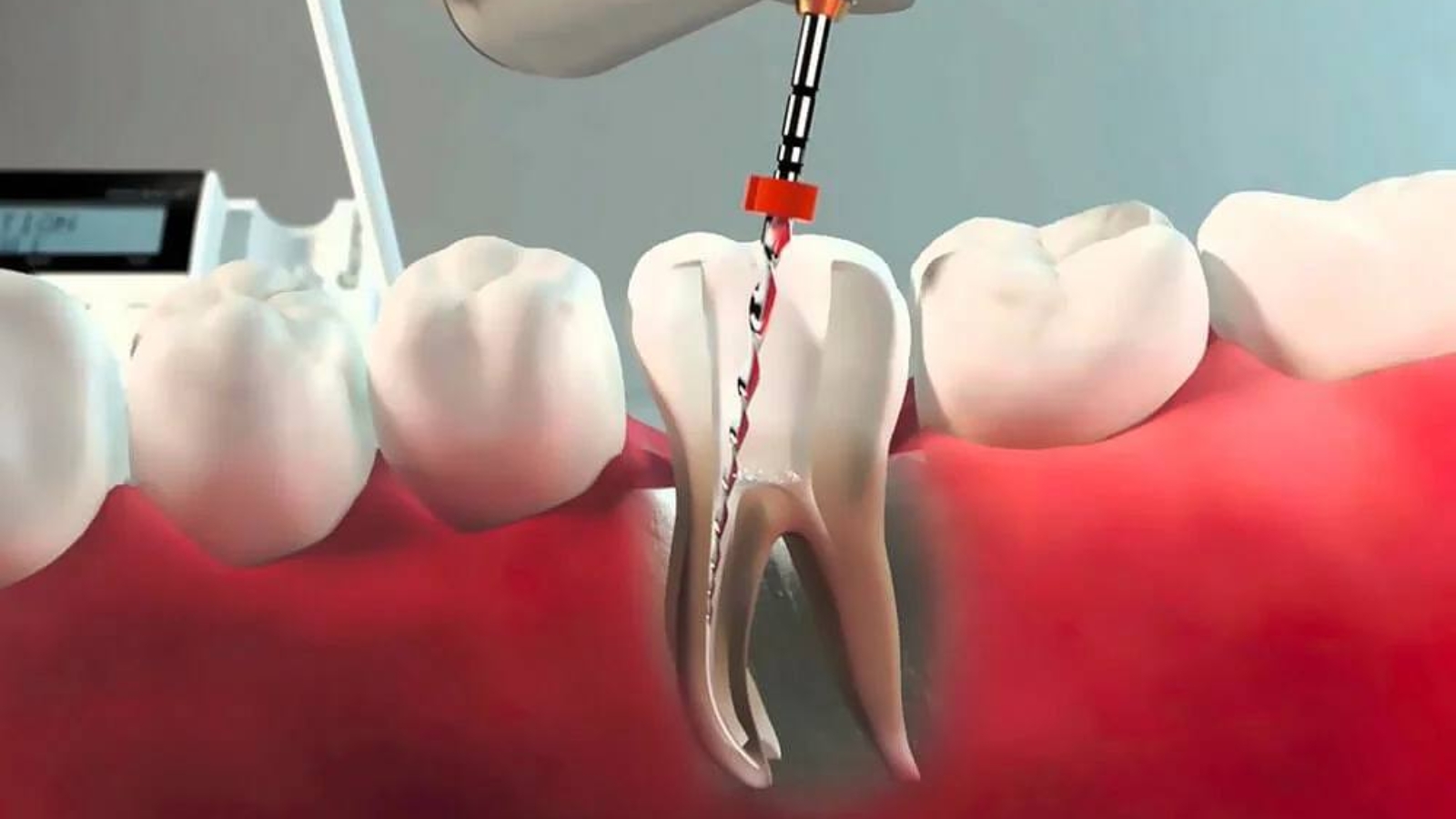 photo_2026-03-31_11-34-45