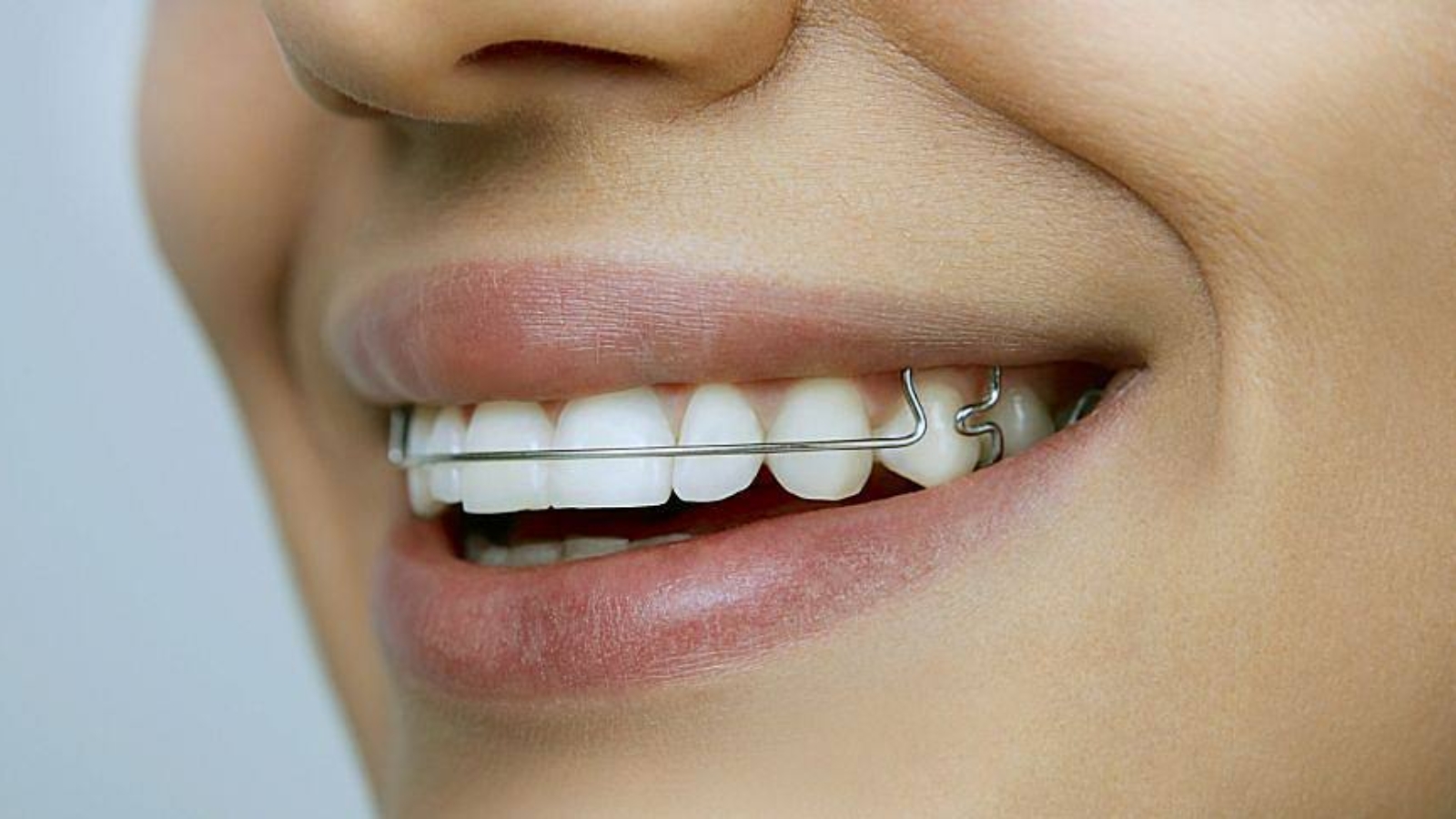 photo_2026-04-01_11-28-04