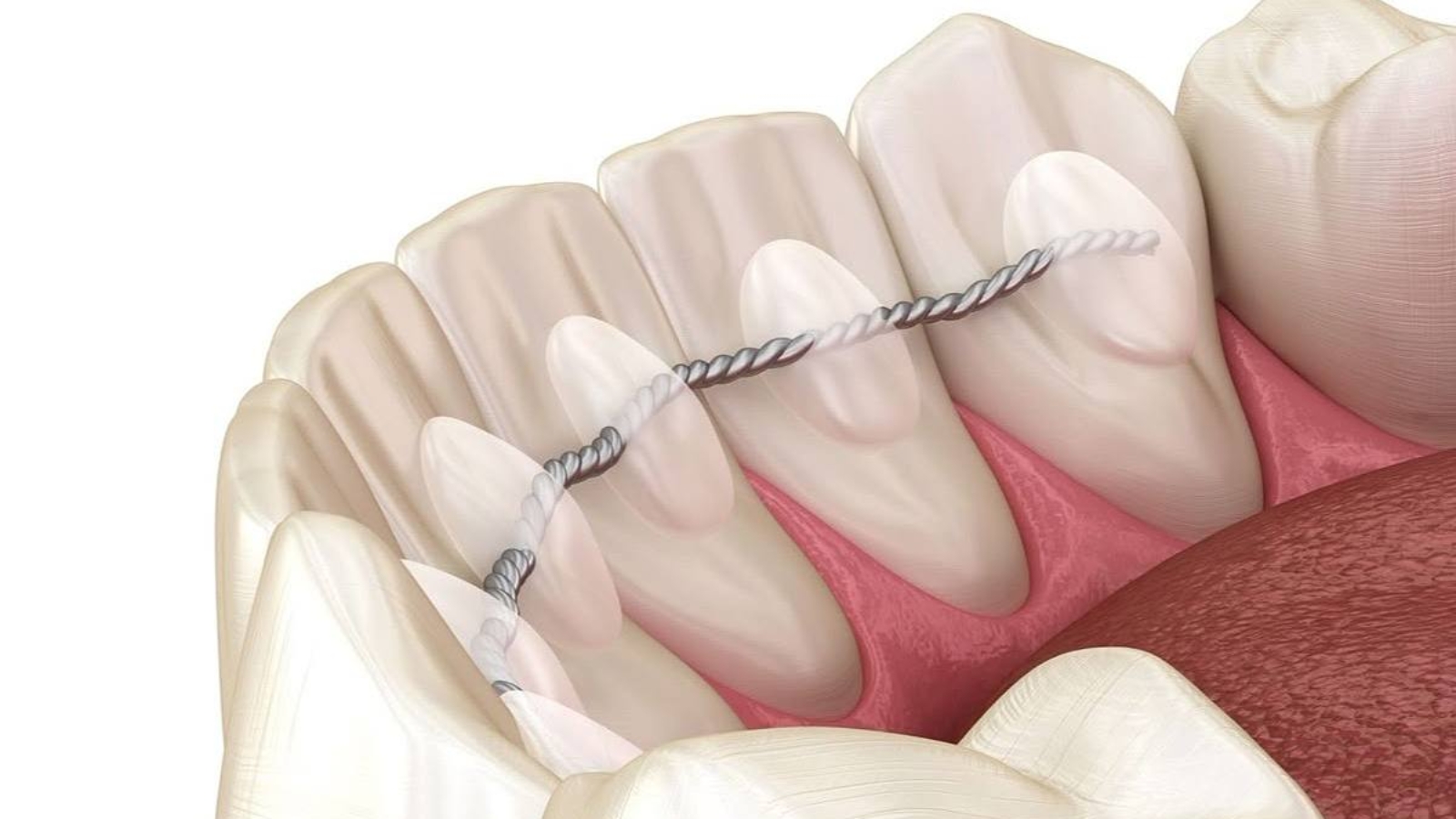 photo_2026-04-03_11-31-42