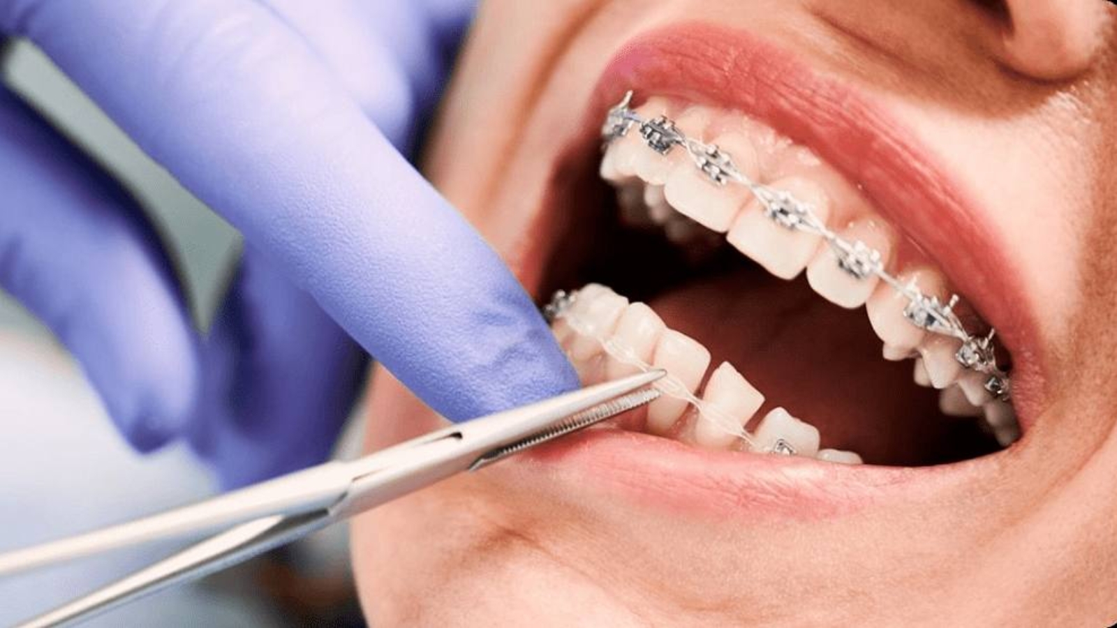 photo_2026-04-10_11-59-02