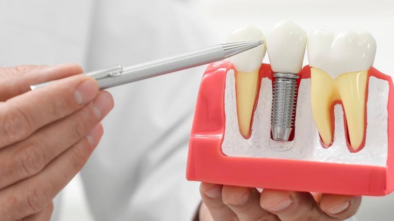 photo_2026-04-17_08-58-07