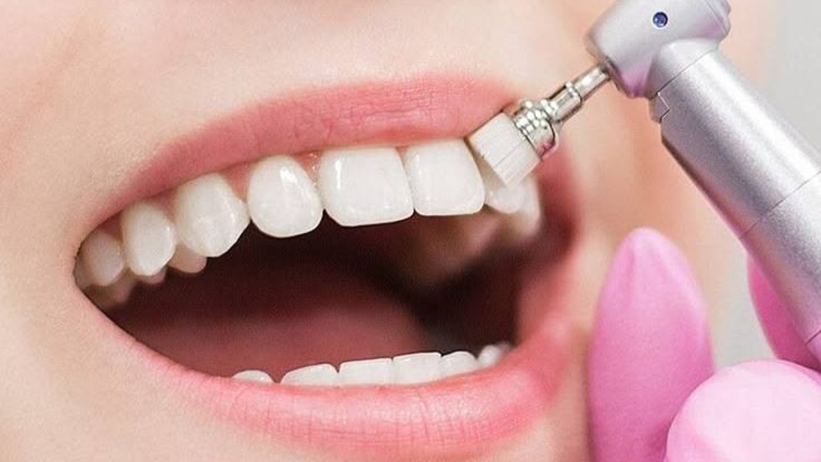 photo_2026-04-17_08-58-19