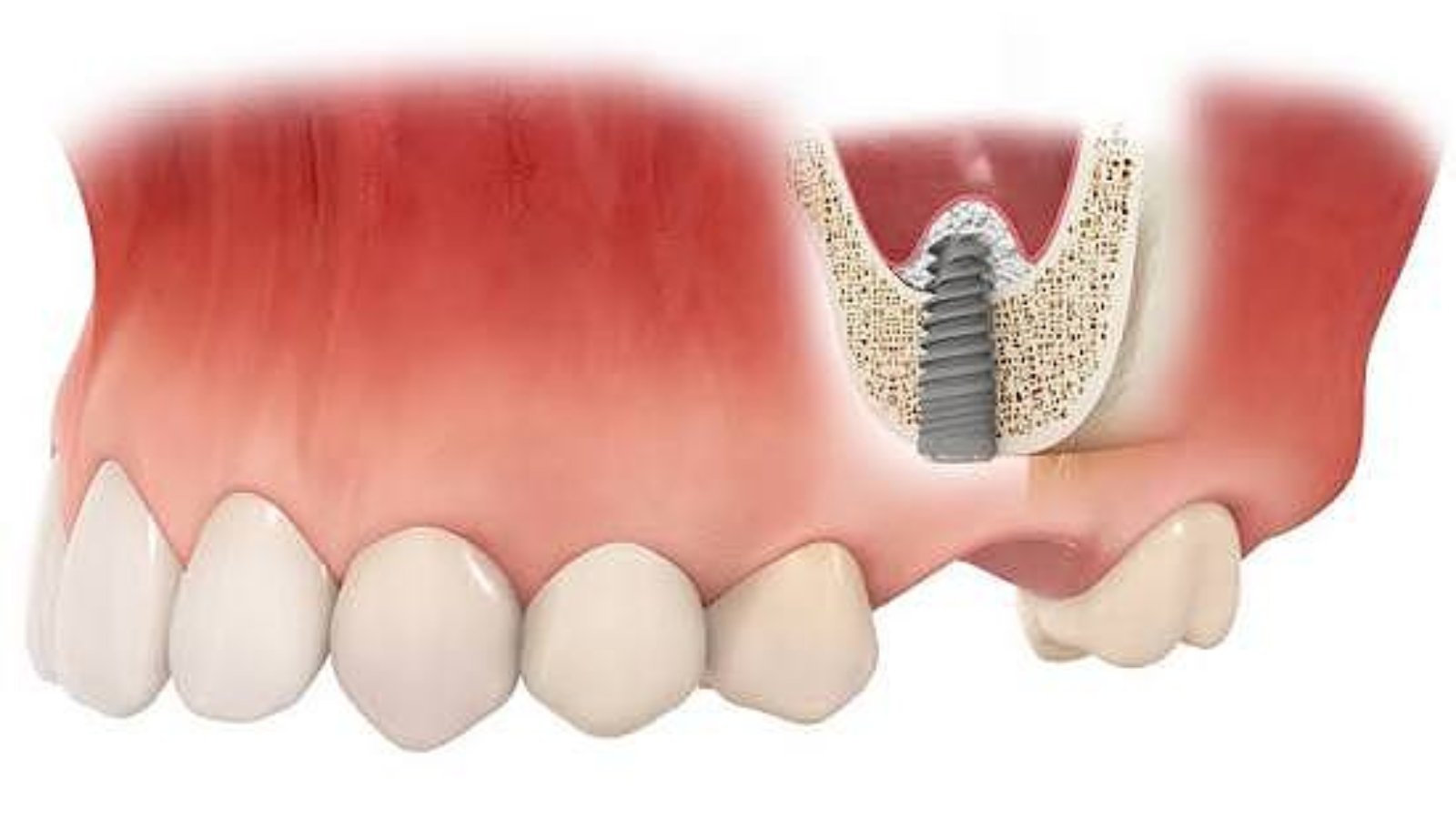 photo_2026-04-20_11-31-09