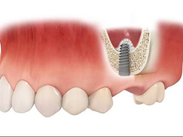 photo_2026-04-20_11-31-09